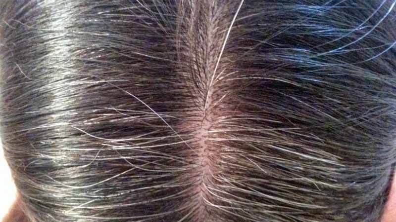 Ubanan di Usia yang Masih Muda? Coba Atasi Dengan 4 Langkah Jitu