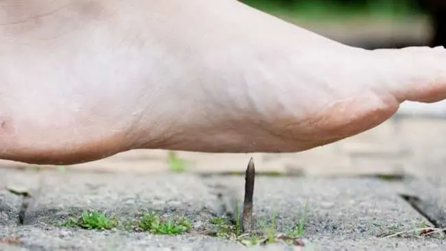 Tetanus Bisa Mematikan, Segera Atasi dengan Cara Ini