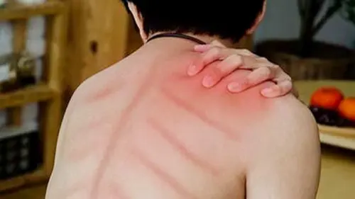 Kehujanan Bukanlah Penyebab Masuk Angin, Ini Faktanya