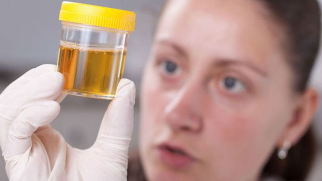 Menggunakan Urin Dapat Membuat Sistem Pangan Lebih Berkelanjutan, Benarkah?